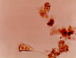 ボルティケラ（Vorticella）