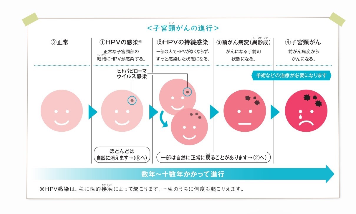 口腔HPVはどのように治療されますか?